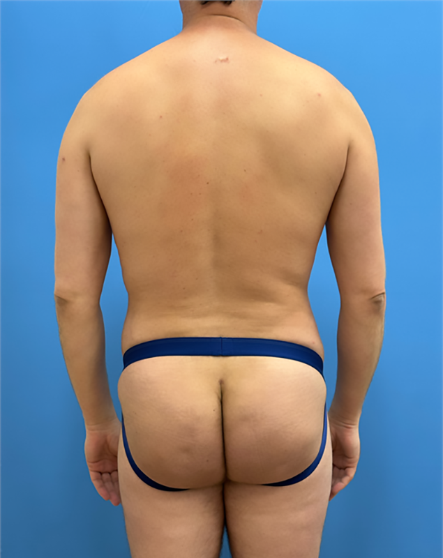 After - Back Profile